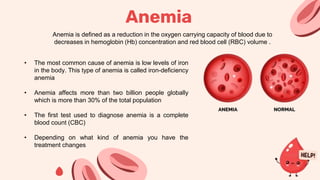 Anemia is defined as a reduction in the oxygen carrying capacity of blood due to
decreases in hemoglobin (Hb) concentration and red blood cell (RBC) volume .
• The most common cause of anemia is low levels of iron
in the body. This type of anemia is called iron-deficiency
anemia
• Anemia affects more than two billion people globally
which is more than 30% of the total population
• The first test used to diagnose anemia is a complete
blood count (CBC)
• Depending on what kind of anemia you have the
treatment changes
Anemia
 