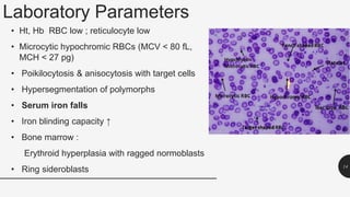 Laboratory Parameters
• Ht, Hb RBC low ; reticulocyte low
• Microcytic hypochromic RBCs (MCV < 80 fL,
MCH < 27 pg)
• Poikilocytosis & anisocytosis with target cells
• Hypersegmentation of polymorphs
• Serum iron falls
• Iron blinding capacity ↑
• Bone marrow :
Erythroid hyperplasia with ragged normoblasts
• Ring sideroblasts 14
 