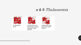 α & β-Thalassemia
29
 