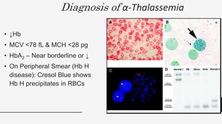 Diagnosis of α-Thalassemia
• ↓Hb
• MCV <78 fL & MCH <28 pg
• HbA2 – Near borderline or ↓
• On Peripheral Smear (Hb H
disease): Cresol Blue shows
Hb H precipitates in RBCs
33
 