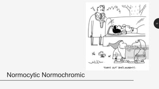 Normocytic Normochromic
49
 