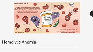 Hemolytic Anemia
50
 