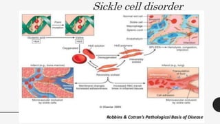 Sickle cell disorder
59
 