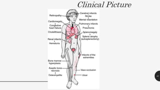 Clinical Picture
61
 