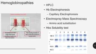 Hemoglobinopathies
• HPLC
• Hb Electrophoresis
– Capillary Electrophoresis
• Electrospray Mass Spectroscopy
– Amino acid substitution
• Hbs Solubility test
75
 