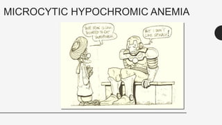 MICROCYTIC HYPOCHROMIC ANEMIA
8
 