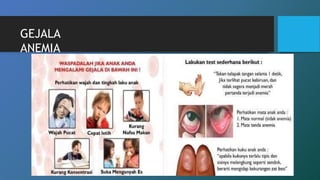 GEJALA
ANEMIA
 