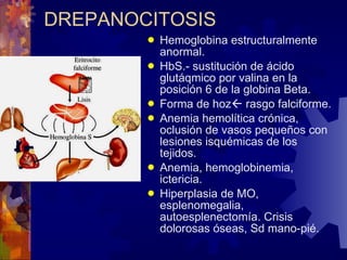DREPANOCITOSIS Hemoglobina estructuralmente anormal. HbS.- sustitución de ácido glutáqmico por valina en la posición 6 de la globina Beta. Forma de hoz   rasgo falciforme. Anemia hemolítica crónica, oclusión de vasos pequeños con lesiones isquémicas de los tejidos. Anemia, hemoglobinemia, ictericia. Hiperplasia de MO, esplenomegalia, autoesplenectomía. Crisis dolorosas óseas, Sd mano-pié. 