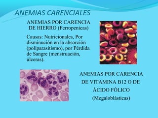 ANEMIAS CARENCIALES
   ANEMIAS POR CARENCIA
   DE HIERRO (Ferropenicas)
  Causas: Nutricionales, Por
  disminución en la absorción
  (poliparasitismo), por Pérdida
  de Sangre (menstruación,
  úlceras).

                           ANEMIAS POR CARENCIA
                            DE VITAMINA B12 O DE
                                   ÁCIDO FÓLICO
                                   (Megaloblásticas)
 
