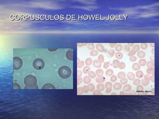 CORPUSCULOS DE HOWEL-JOLLYCORPUSCULOS DE HOWEL-JOLLY
 