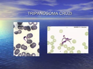 TRIPANOSOMA CRUZITRIPANOSOMA CRUZI
 