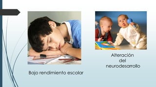 Bajo rendimiento escolar
Alteración
del
neurodesarrollo
 
