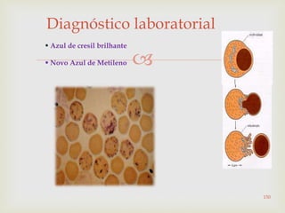 
 Azul de cresil brilhante
 Novo Azul de Metileno
Diagnóstico laboratorial
150
 