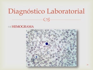 
Diagnóstico Laboratorial
 HEMOGRAMA
25
 