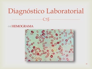 
Diagnóstico Laboratorial
 HEMOGRAMA
26
 