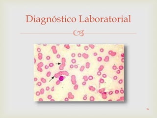 
Diagnóstico Laboratorial
36
 