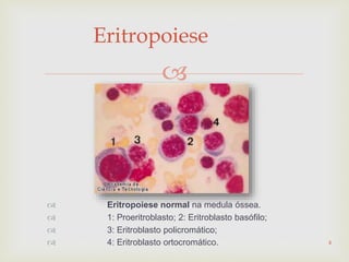 
Eritropoiese
 Eritropoiese normal na medula óssea.
 1: Proeritroblasto; 2: Eritroblasto basófilo;
 3: Eritroblasto policromático;
 4: Eritroblasto ortocromático. 4
 