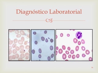
Diagnóstico Laboratorial
56
 