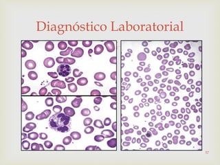 
Diagnóstico Laboratorial
57
 