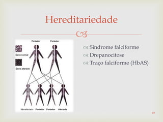 
Hereditariedade
 Síndrome falciforme
 Drepanocitose
 Traço falciforme (HbAS)
69
 