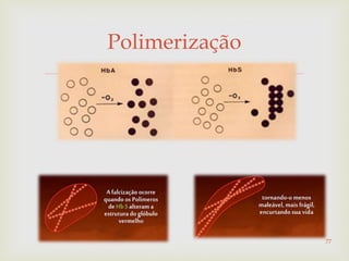 
Polimerização
77
 
