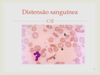 
Distensão sanguínea
79
 