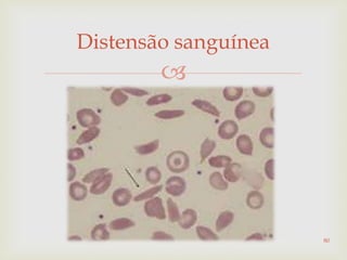 
Distensão sanguínea
80
 