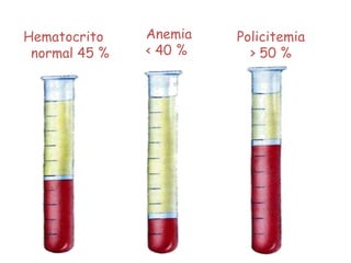 Hematocrito
normal 45 %
Anemia
< 40 %
Policitemia
> 50 %
 