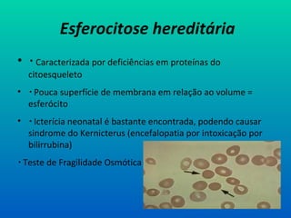 Esferocitose hereditária
•  Caracterizada por deficiências em proteínas do
citoesqueleto
•  Pouca superfície de membrana em relação ao volume =
esferócito
•  Icterícia neonatal é bastante encontrada, podendo causar
sindrome do Kernicterus (encefalopatia por intoxicação por
bilirrubina)
 Teste de Fragilidade Osmótica
 