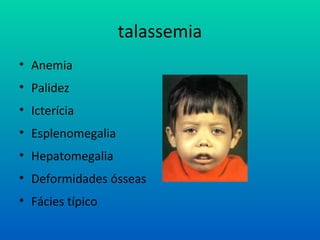 talassemia
• Anemia
• Palidez
• Icterícia
• Esplenomegalia
• Hepatomegalia
• Deformidades ósseas
• Fácies típico
 