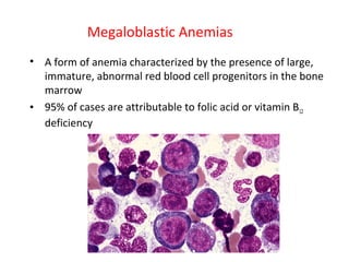 Megaloblastic Anemias
• A form of anemia characterized by the presence of large,
immature, abnormal red blood cell progenitors in the bone
marrow
• 95% of cases are attributable to folic acid or vitamin B12
deficiency
 