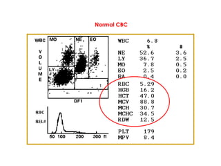 Normal CBC
 
