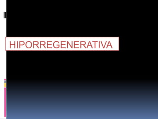 HIPORREGENERATIVA
 