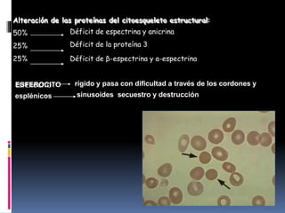 Alteración de las proteínas del citoesqueleto estructural:
50%
25%
25%
Déficit de espectrina y anicrina
Déficit de la proteína 3
Déficit de β-espectrina y a-espectrina
ESFEROCITO
esplénicos
rígido y pasa con dificultad a través de los cordones y
sinusoides secuestro y destrucción
 