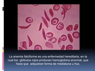 La anemia falciforme es una enfermedad hereditaria, en la
cual los glóbulos rojos producen hemoglobina anormal, que
hace que adquieran forma de medialuna u hoz.
 