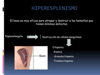 El bazo es muy eficaz para atrapar y destruir a los hematíes que
tienen mínimos defectos
Esplenomegalia Destrucción de células sanguíneas
Citopenia:
-Anemia
- Granulocitopenia
-Trombocitopenia
HIPERESPLENISMO
 