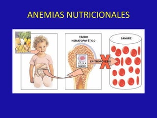 ANEMIAS NUTRICIONALES
 