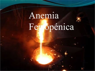 Anemia
Ferropénica
 