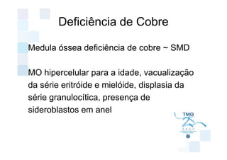 Deficiência de Cobre

Medula óssea deficiência de cobre ~ SMD

MO hipercelular para a idade, vacualização
da série eritróide e mielóide, displasia da
série granulocítica, presença de
sideroblastos em anel
 