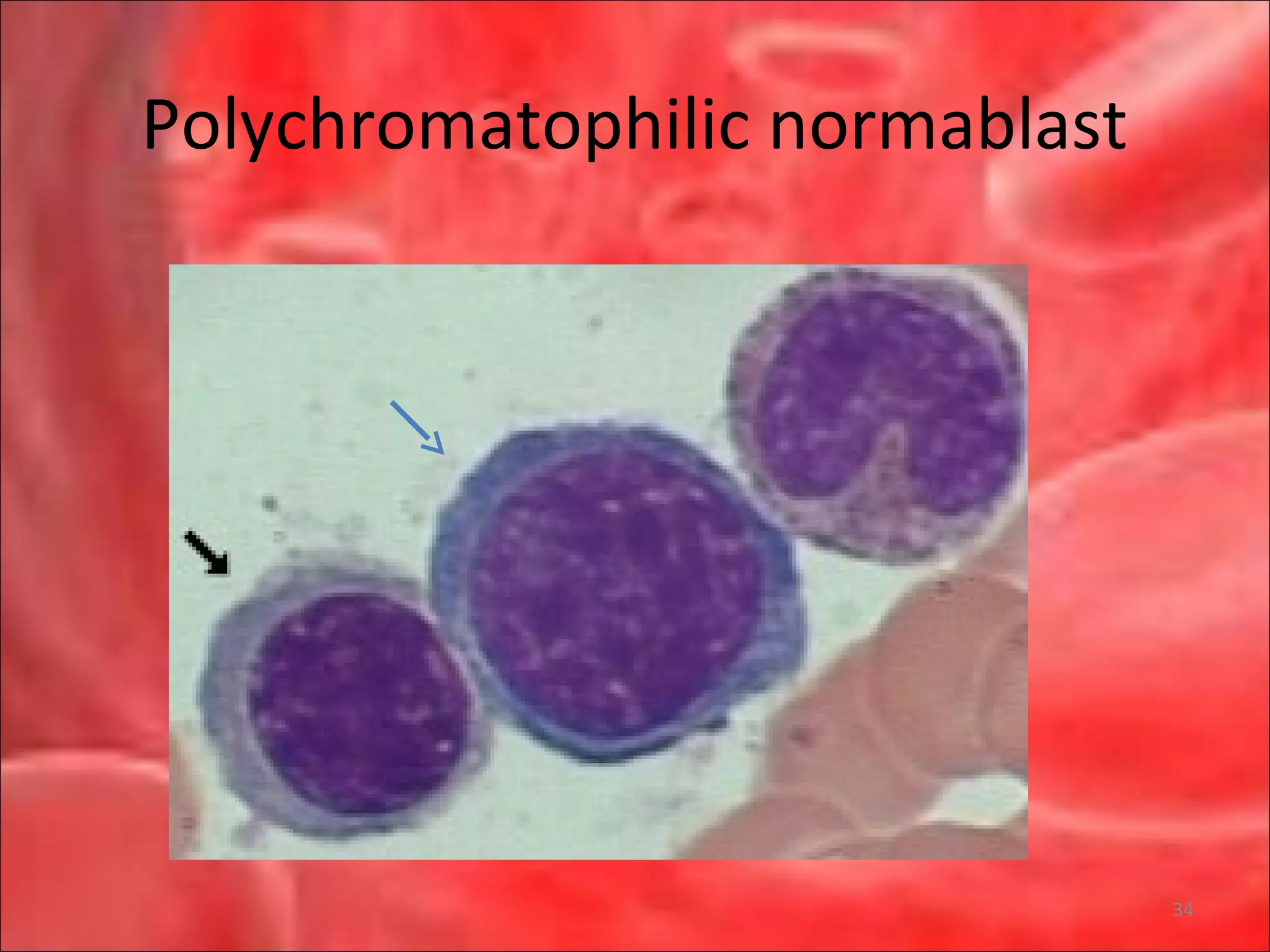 Polychromatophilic normablast
34
 