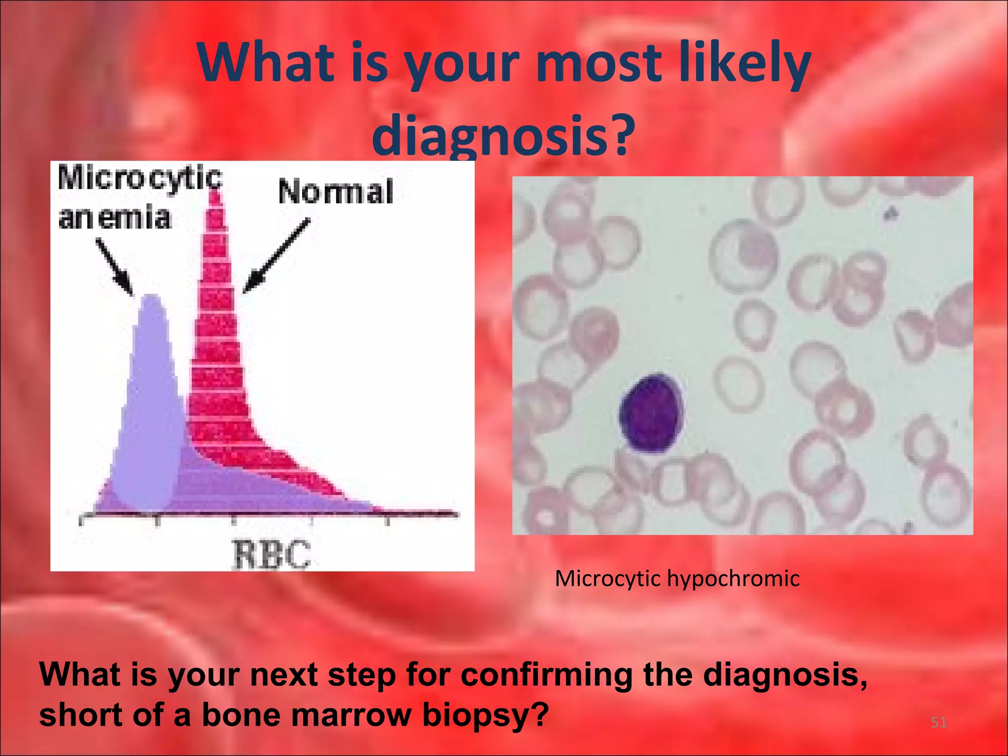 What is your most likely
diagnosis?
Microcytic hypochromic
What is your next step for confirming the diagnosis,
short of a bone marrow biopsy? 51
 