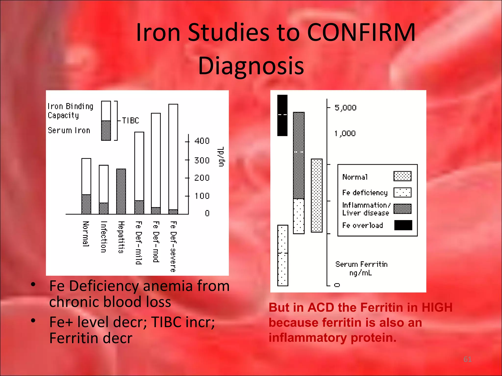 Iron Studies to CONFIRM
Diagnosis
• Fe Deficiency anemia from
chronic blood loss
• Fe+ level decr; TIBC incr;
Ferritin decr
But in ACD the Ferritin in HIGH
because ferritin is also an
inflammatory protein.
61
 
