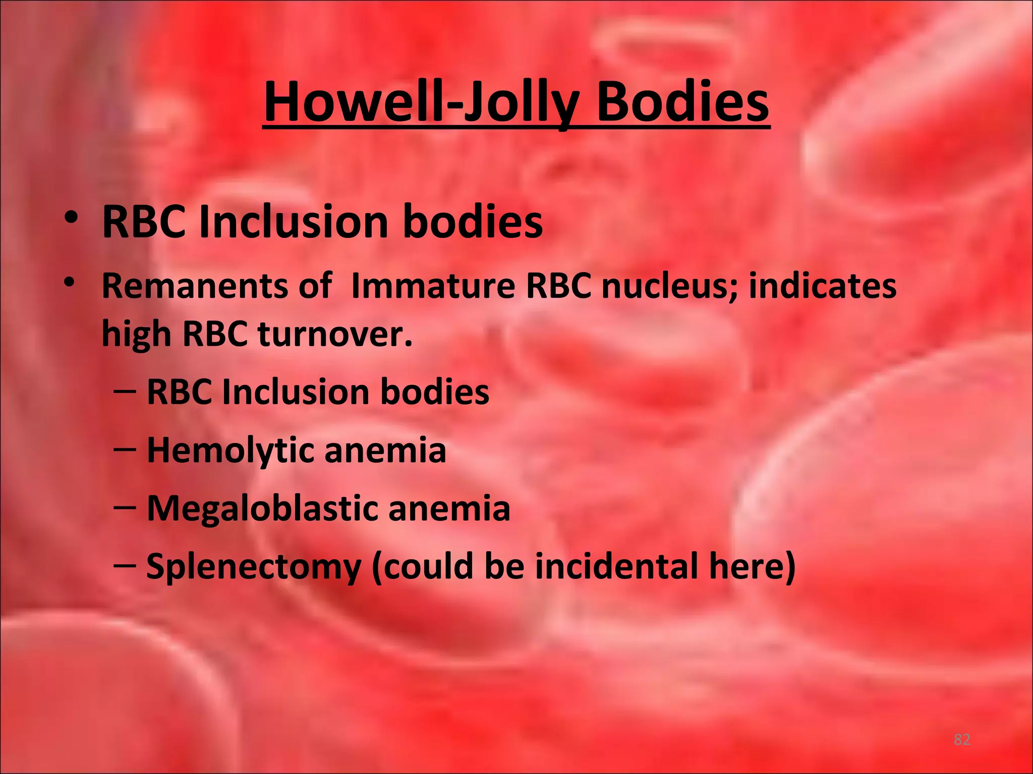 Howell-Jolly Bodies
• RBC Inclusion bodies
• Remanents of Immature RBC nucleus; indicates
high RBC turnover.
– RBC Inclusion bodies
– Hemolytic anemia
– Megaloblastic anemia
– Splenectomy (could be incidental here)
82
 