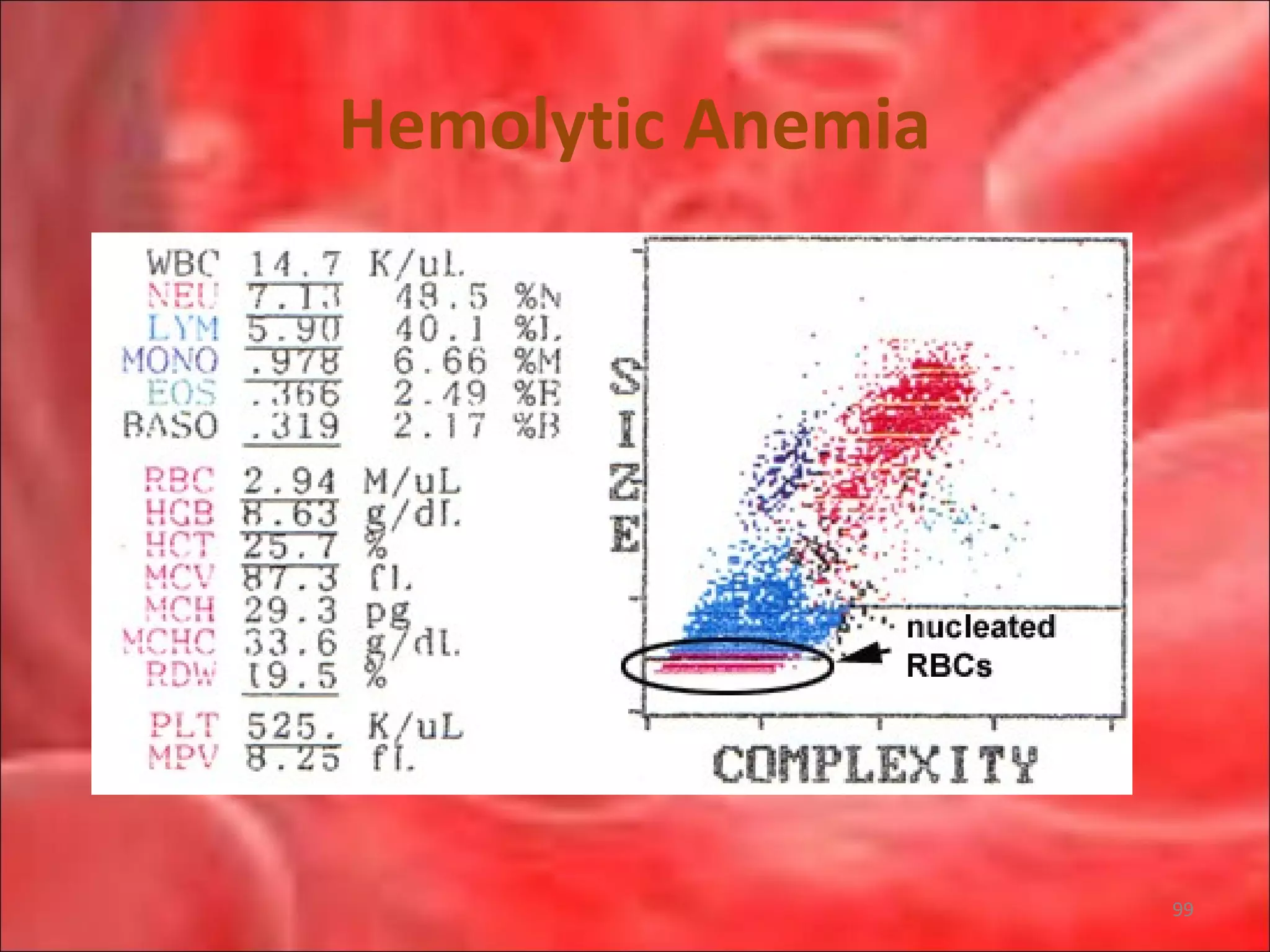 Hemolytic Anemia
99
 