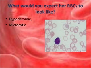 Anemias interpretation of cbc 2010rev | PPT