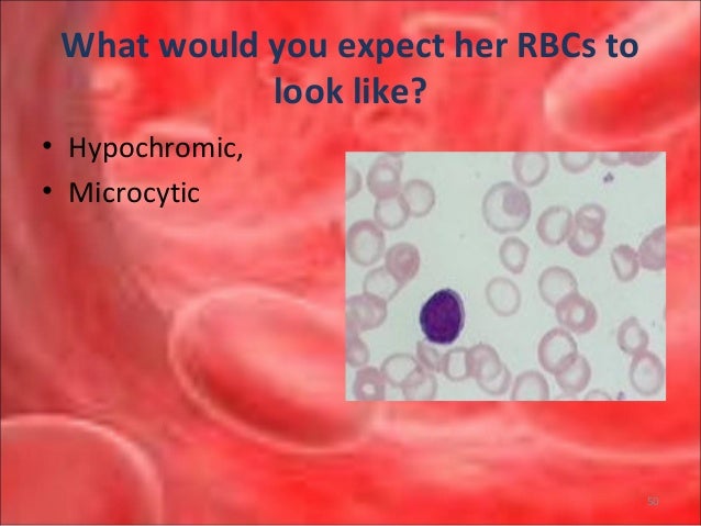 Anemias interpretation of cbc 2010rev