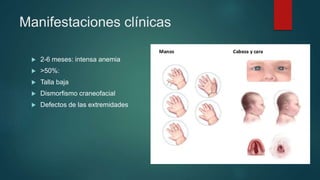 Manifestaciones clínicas
 2-6 meses: intensa anemia
 >50%:
 Talla baja
 Dismorfismo craneofacial
 Defectos de las extremidades
 