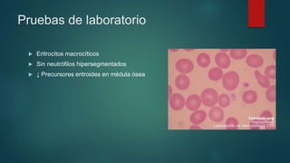 Pruebas de laboratorio
 Eritrocitos macrocíticos
 Sin neutrófilos hipersegmentados
 ↓ Precursores eritroides en médula ósea
 