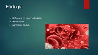 Etiología
 Deficiencia de hierro en la dieta.
 Hemorragias.
 Sangrados ocultos.
 