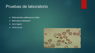 Pruebas de laboratorio
 Reticulocitos esféricos en frotis.
 Bilirrubina indirecta↑
 Hb 6-10g/dL
 VCM normal.
 